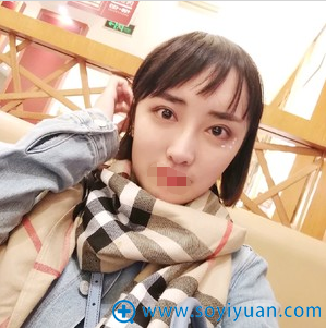 成都美未央周鹏起开外下至半年恢复照 成都美未央周鹏起开外下至半年恢复照