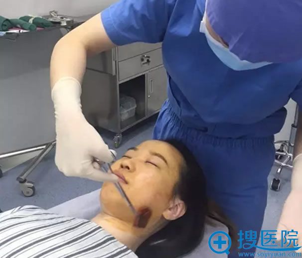 做双眼皮手术前的消毒工作 做双眼皮手术前的消毒工作