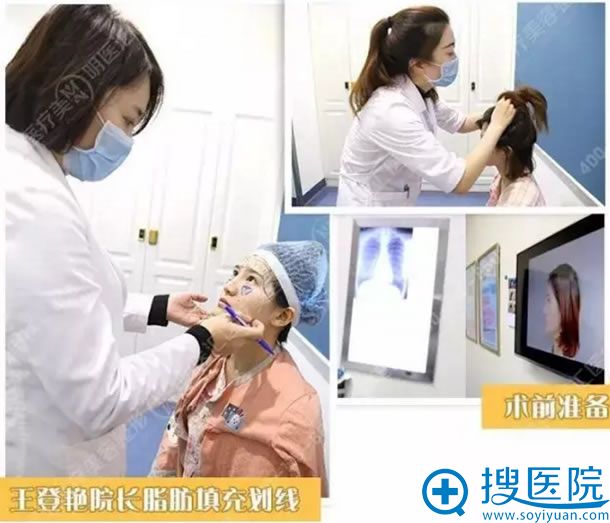 王登艳在长进行脂肪填充手术画线 王登艳在长进行脂肪填充手术画线