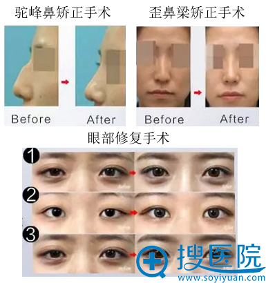 <!--<i data=20240710 data-id=14517></i>-->郑倞旻整形<span style= <!--<i data=20240710 data-id=14517></i>-->郑倞旻整形<span style=