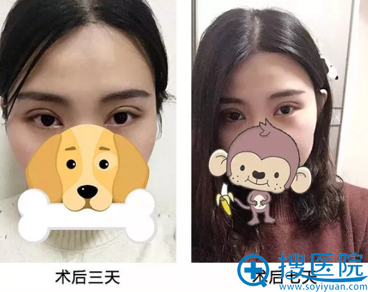 �ÿ���С����˫��Ƥ3��7��Ч��