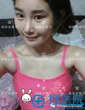 21岁乐乐做隆胸手术前 21岁乐乐做隆胸手术前