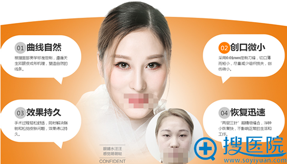 重庆华美整形美容医院美萌双眼皮案例对比 重庆华美整形美容医院美萌双眼皮案例对比