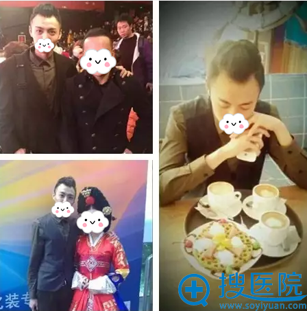 博士园发际线种植术后6个月 陈年腊肉变成了帅气男神