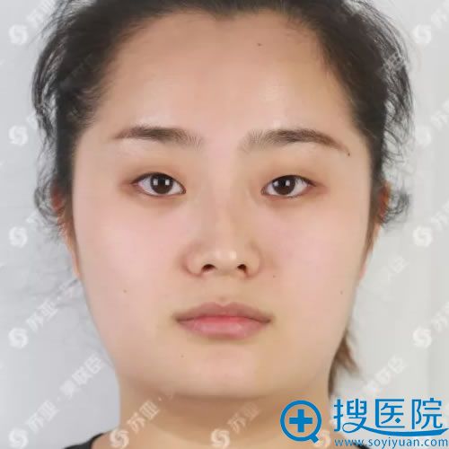 单眼皮小眼睛的小斐 单眼皮小眼睛的小斐