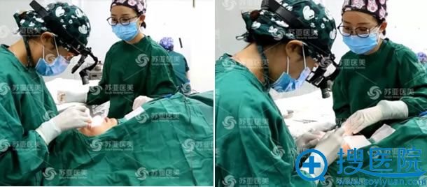 李燕院长为小斐做双眼皮手术过程 李燕院长为小斐做双眼皮手术过程