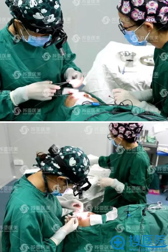 双眼皮手术的缝合过程图 双眼皮手术的缝合过程图
