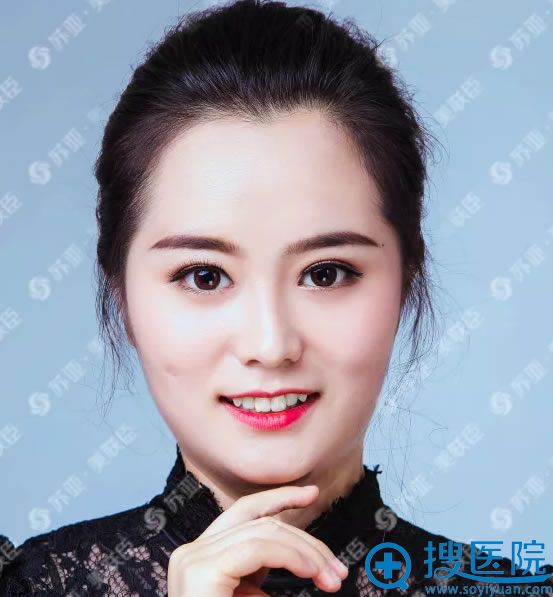 <!--<i data=20240710 data-id=14571></i>-->美联臣李燕眼踪合案例 <!--<i data=20240710 data-id=14571></i>-->美联臣李燕眼踪合案例