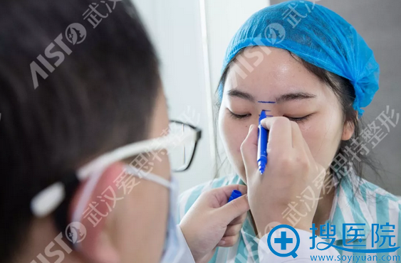 从土妞变小仙女,来看看武汉爱思特做的隆鼻效果怎么样