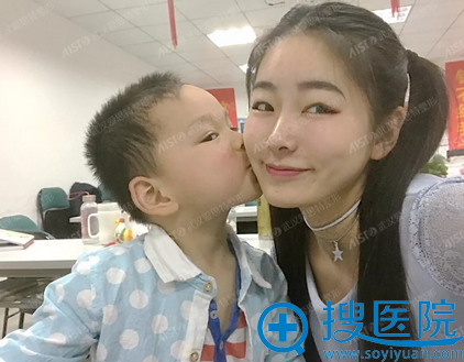 做完隆鼻半个月生活照 做完隆鼻半个月生活照