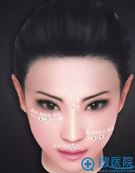 鼻整形手术的六大高光点与四大关键点 鼻整形手术的六大高光点与四大关键点