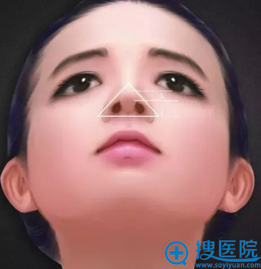 鼻尖整形手术的审美标准 鼻尖整形手术的审美标准