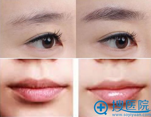 温州恒美半化妆案例图 温州恒美半化妆案例图