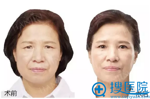 ���������沿����