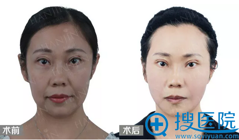�����������沿����������