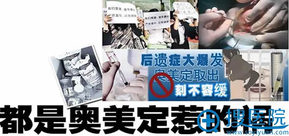 奥美定事件图示 奥美定事件图示