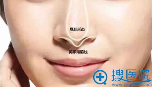 海鸥线的打造标准 海鸥线的打造标准