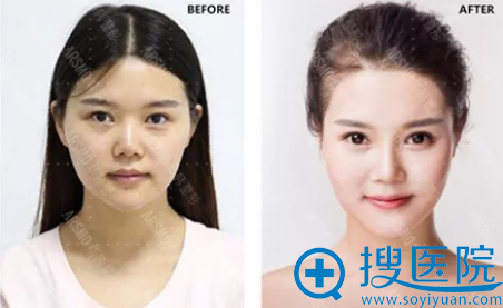 长沙华韩华美整形医院春节变美微计划:我已为您列好变美清单!