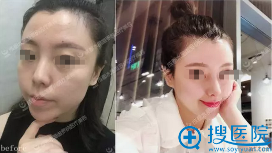 十天从路人到侧颜女神 她在成都水晶唯罗纳究竟做了什么项目?
