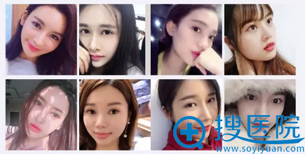 成都美容整形医院整形案例 成都美容整形医院整形案例