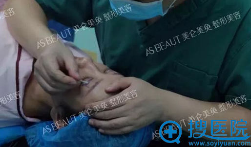 董开云主任开始双眼皮画线 董开云主任开始双眼皮画线