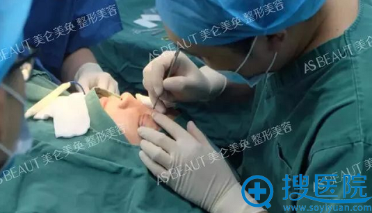 董开云医生为我取出眼部多余脂肪 董开云医生为我取出眼部多余脂肪