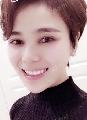 重庆当代微整形明星医生曹美体验牙齿美学修复 缺损牙变炫白牙