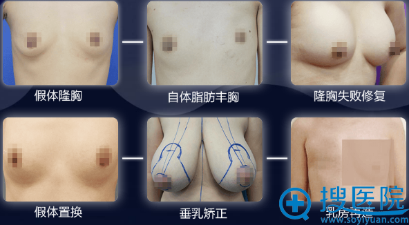 大会案例模特招募范围 大会案例模特招募范围