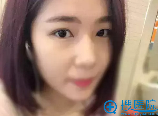 23�굥��Ƥʱ�����Ƭ