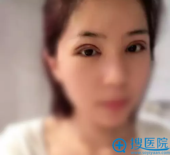 ����������˫��Ƥ������2��ָ���
