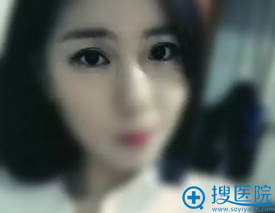 ˫��Ƥ����1���»ָ�Ч��ͼ