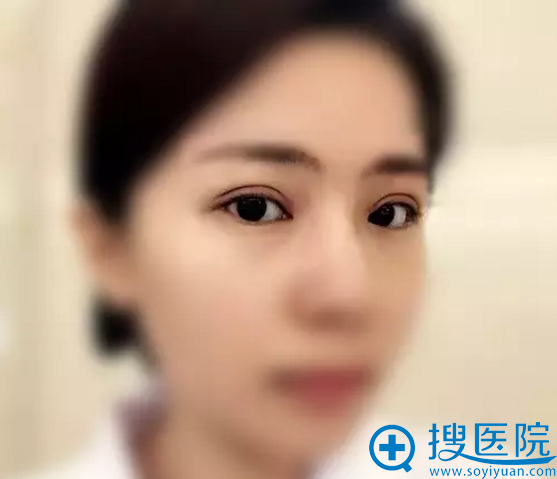 ��������˫��Ƥ��������1����Ч��