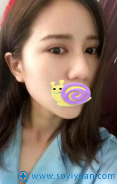15���ˣ��ҵı��ӻָ��Ĳ����ɣ�