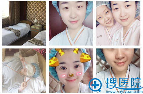 上海yestar双眼皮案例:感谢许炎龙医生圆了我的双眼皮美梦
