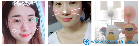 双眼皮第6天的效果图 双眼皮第6天的效果图