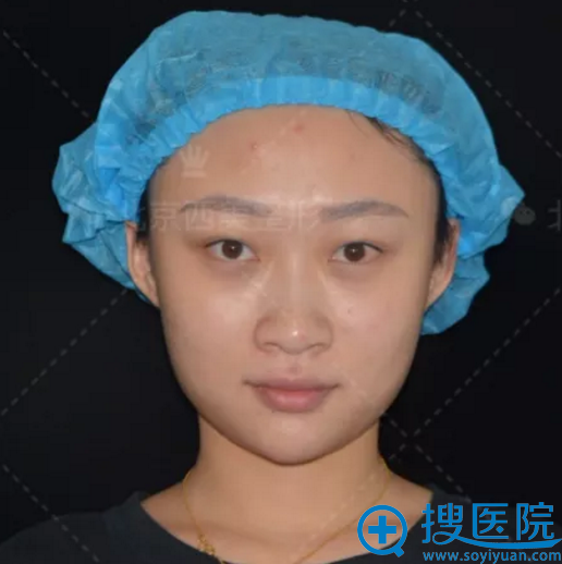 20180126_1516954355414119.png image.png
