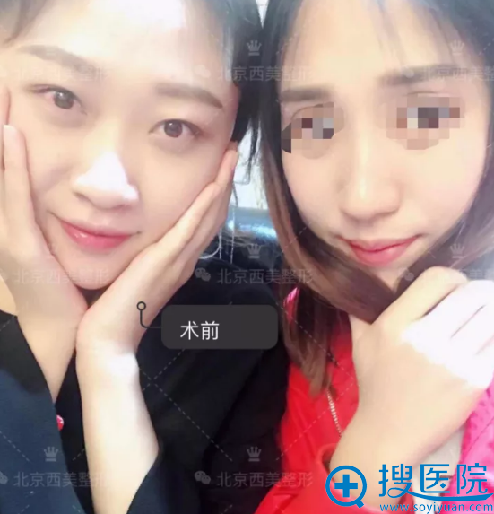 我和双眼皮表妹的合照 我和双眼皮表妹的合照