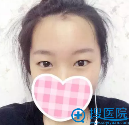 �����ֻ�������ҽԺ��˫��Ƥǰ������