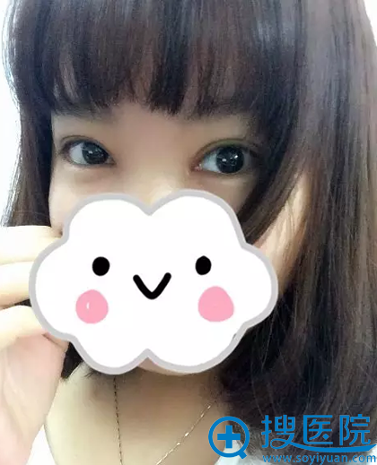 ˫��Ƥ���ߺ����Ƭ