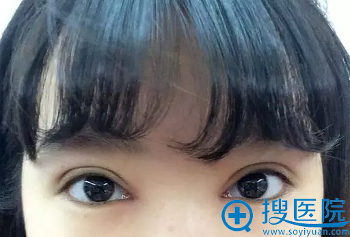 ���ֻ������˫��Ƥ20��ָ�Ч��