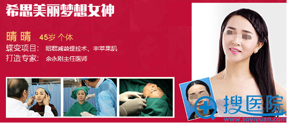 <!--<i data=20240710 data-id=12503></i>-->余永刚减龄提拉术、丰苹果肌案例 <!--<i data=20240710 data-id=12503></i>-->余永刚减龄提拉术、丰苹果肌案例