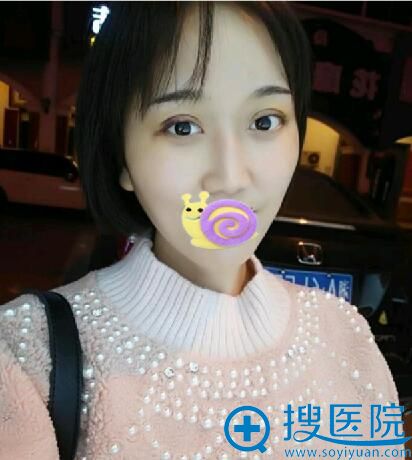 术后第七天 刚拆完线 术后第七天 刚拆完线