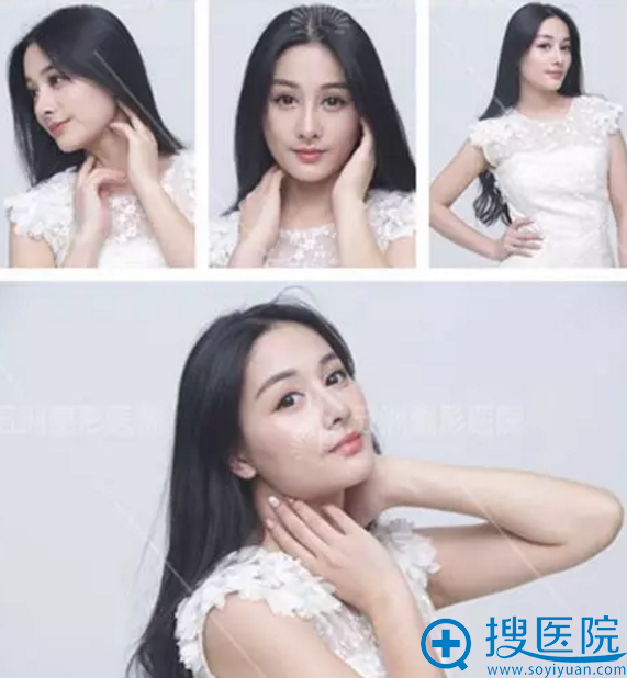 �人����Ժ�����ۺϰ���1���»ָ�Ч��