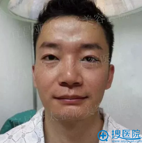 综合隆下巴前的较后一张照片 综合隆下巴前的较后一张照片