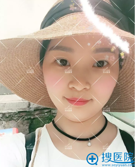 美颜之后的塌鼻子照片 美颜之后的塌鼻子照片