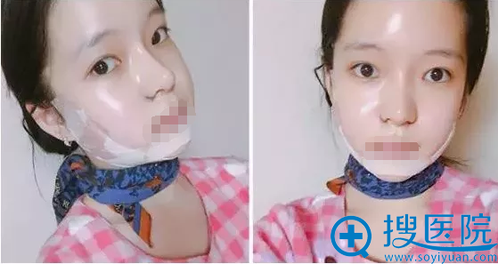 ֬������沿4����г�������