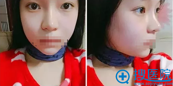 �Ͼ�ά������֬������沿2��