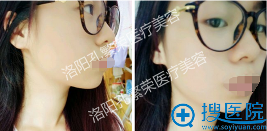 术后十<span style= 术后十<span style=