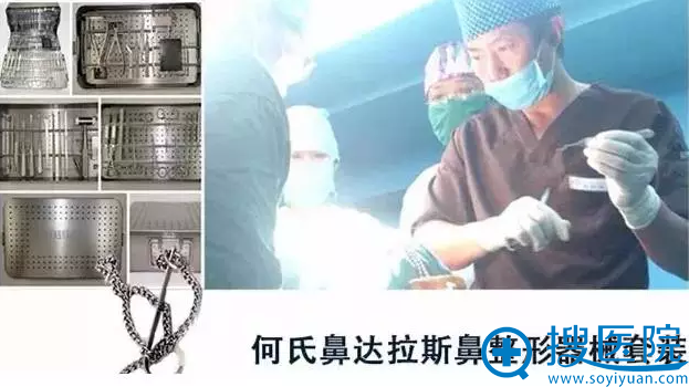 阿氏鼻达拉斯鼻整形器械 阿氏鼻达拉斯鼻整形器械