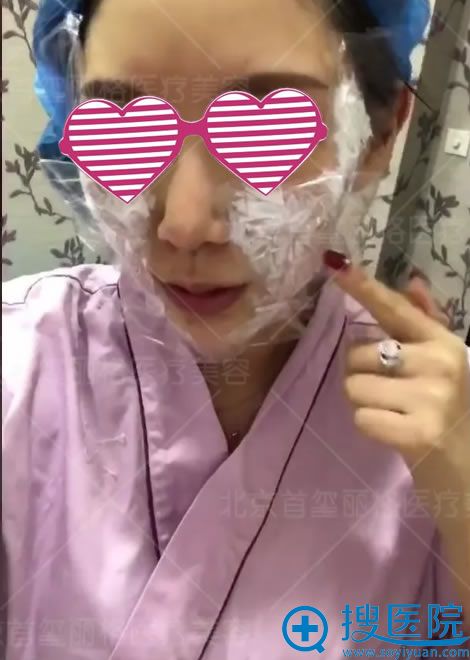 线雕手术之麻醉过程 线雕手术之麻醉过程